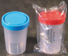 Container 200ml, Sterile - box of  200 uni